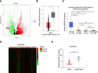 A Crucial Angiogenesis-Associated Gene MEOX2 Could Be a Promising Biomarker Candidate for Breast Cancer